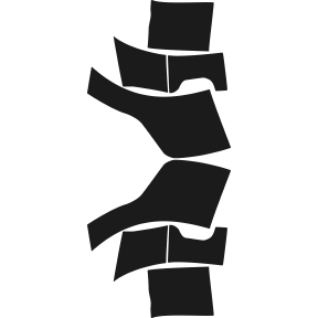 Splash 2009-2012 Mitsubishi Eclipse 12-09 2D Cpe PPF